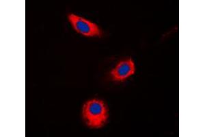 Immunofluorescent analysis of Aldose Reductase staining in Jurkat cells. (AKR1B1 抗体  (C-Term))