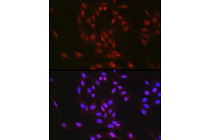 Immunofluorescence analysis of NIH/3T3 cells using RBM14 Rabbit pAb (ABIN6133649, ABIN6146760, ABIN6146762 and ABIN6217049) at dilution of 1:350 (40x lens). (RBM14 抗体  (AA 500-600))
