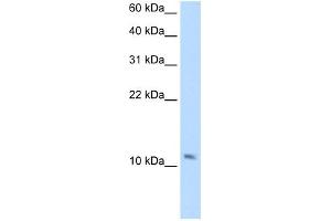 SMPX antibody used at 2.