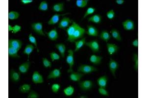 Immunofluorescence staining of A549 cells with ABIN7160623 at 1:166, counter-stained with DAPI. (DMPK 抗体  (AA 243-424))