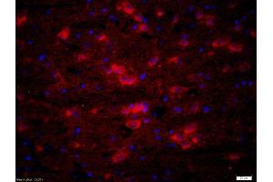 Formalin-fixed and paraffin-embedded rat brain labeled with Rabbit Anti-ATX2 Polyclonal Antibody, Unconjugatedused at 1:200 dilution for 40 minutes at 37°C. (Ataxin 2 抗体  (AA 775-856))