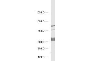 dilution: 1 : 1000, sample: rat brain homogenate (GPM6A 抗体)