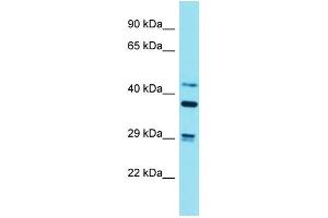 Western Blotting (WB) image for anti-Striatin, Calmodulin Binding Protein 3 (STRN3) (N-Term) antibody (ABIN2789947) (STRN3 抗体  (N-Term))