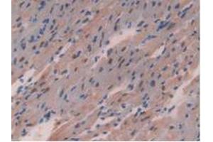 Detection of CHD3 in Mouse Heart Tissue using Polyclonal Antibody to Chromodomain Helicase DNA Binding Protein 3 (CHD3) (CHD3 抗体  (AA 1613-1820))
