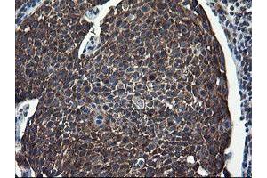 Image no. 5 for anti-CCR4-NOT Transcription Complex Subunit 4 (CNOT4) (AA 190-455) antibody (ABIN1491098)