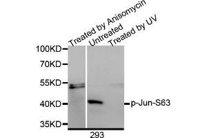 Western Blotting (WB) image for anti-Jun Proto-Oncogene (JUN) (pSer63) antibody (ABIN3023571) (C-JUN 抗体  (pSer63))