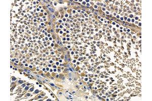 ABIN7096853 and ABIN7100919 at 1/100 staining rat testis tissue by IHC-P. (TOM1L1 抗体)