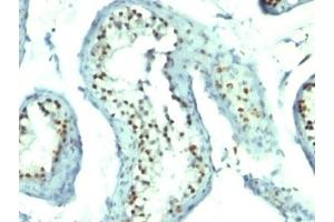 Immunohistochemistry (Formalin-fixed Paraffin-embedded Sections) (IHC (fp)) image for anti-Nucleolin (NCL) antibody (ABIN3025717)