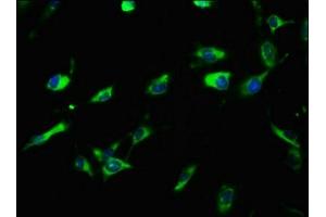 Immunofluorescence staining of U251 cells with ABIN7158211 at 1:100, counter-stained with DAPI. (LRIG3 抗体  (AA 835-985))