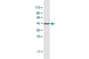 Western Blot detection against Immunogen (44. (NUDCD2 抗体  (AA 1-157))