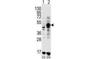 Western Blotting (WB) image for anti-Growth Differentiation Factor 9 (GDF9) antibody (ABIN3001444) (GDF9 抗体)