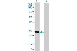Western Blot analysis of PSMD8 expression in transfected 293T cell line by PSMD8 MaxPab polyclonal antibody. (PSMD8 抗体  (AA 1-257))
