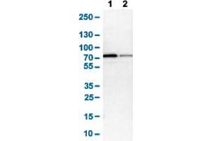 Western Blot analysis of (1) NIH-3T3 cell lysate (Mouse embryonic fibroblast cells), and (2) NBT-II cell lysate (Rat Wistar bladder tumour cells). (Glucose-6-Phosphate Dehydrogenase 抗体  (AA 43-154))