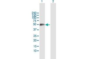 Western Blot analysis of TEX13A expression in transfected 293T cell line by TEX13A MaxPab polyclonal antibody. (TEX13A 抗体  (AA 1-409))