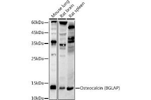 Western blot analysis of extracts of various cell lines, using Osteocalcin (BGLAP) antibody (ABIN7269118) at 1:1000 dilution. (Osteocalcin 抗体)