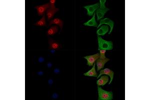 Phospho-JIP1 (Thr205) Antibody staining Hela cells(heat shock treatment) by IF/ICC. (MAPK8IP1 抗体  (pThr205))