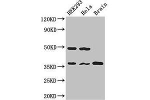 Western Blot Positive WB detected in: HEK293 whole cell lysate, Hela whole cell lysate, Mouse brain tissue All lanes: PPP1CC antibody at 2. (PPP1CC 抗体  (Catalytic Subunit))
