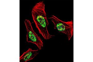 Fluorescent confocal image of Hela cell stained with NR2C2 Antibody . (TR4 抗体  (C-Term))