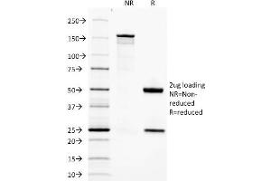 SDS-PAGE (SDS) image for anti-Adiponectin (ADIPOQ) (AA 145-226) antibody (ABIN6941122)