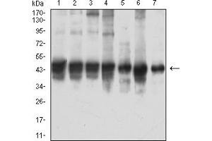 Western Blotting (WB) image for anti-Actin, alpha 2, Smooth Muscle, Aorta (ACTA2) (AA 2-124) antibody (ABIN7193571)