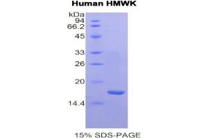 SDS-PAGE analysis of Human HMWK Protein. (Kininogen (HMW) 蛋白)