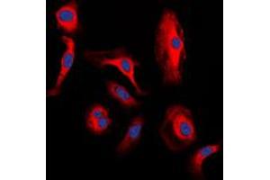 Immunofluorescent analysis of WNT1 staining in H9C2 cells. (WNT1 抗体  (C-Term))