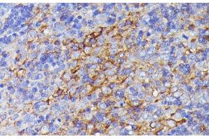 Immunohistochemistry of paraffin-embedded Rat lymph node using SNAP23 Polyclonal Antibody at dilution of 1:100 (40x lens). (SNAP23 抗体)