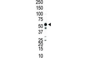 Western blot analysis of JNK2 antibody and Jurkat cell lysate. (JNK2 抗体  (AA 349-379))