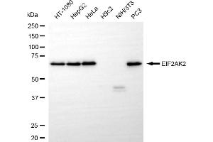 Western blotting analysis using EIF2AK2 antibody (ABIN7798507). (Recombinant EIF2AK2 抗体)