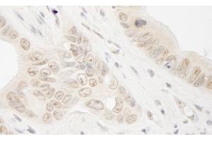 Immunohistochemistry (IHC) image for anti-RAD54-Like 2 (RAD54L2) (AA 75-125) antibody (ABIN7448419)