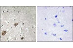 Immunohistochemistry (IHC) image for anti-Brain-Enriched Guanylate Kinase-Associated (BEGAIN) (AA 511-560) antibody (ABIN2889742)