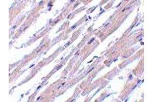 Immunohistochemistry of BCL2L13 in human heart tissue with BCL2L13 polyclonal antibody  at 10 ug/mL . (BCL2L13 抗体  (Internal Region))
