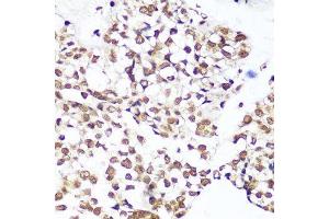 Immunohistochemistry of paraffin-embedded human breast using H3K9me1 antibody.