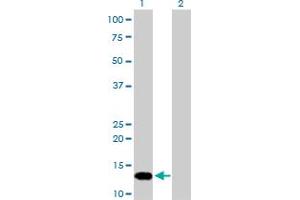Western Blot analysis of FKBP1A expression in transfected 293T cell line by FKBP1A monoclonal antibody (M01), clone 1E5-A12. (FKBP1A 抗体  (AA 1-108))