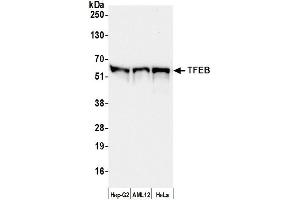 Western Blotting (WB) image for anti-Transcription Factor EB (TFEB) (AA 426-476) antibody (ABIN7450814) (TFEB 抗体  (AA 426-476))