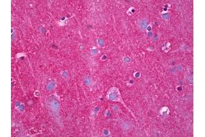 Anti-NDRG4 antibody IHC of human brain, cortex neuropil. (NDRG4 抗体  (AA 1-340))