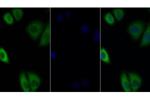 Detection of IL27Ra in Human MCF7 cell using Polyclonal Antibody to Interleukin 27 Receptor Alpha (IL27Ra) (IL27 Receptor alpha 抗体  (AA 93-273))