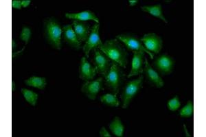 Immunofluorescence staining of A549 cells with ABIN7146942 at 1:200, counter-stained with DAPI.
