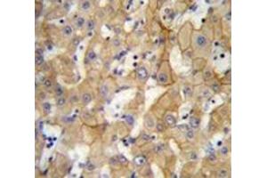 Immunohistochemistry analysis in human liver tissue (Formalin-fixed, Paraffin-embedded) using SPACA5 Antibody , followed by peroxidase conjugation of the secondary antibody and DAB staining. (SPACA5 抗体  (Middle Region))