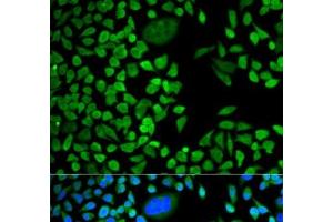 Immunofluorescence analysis of HeLa cells using TIA1 Polyclonal Antibody (TIA1 抗体)