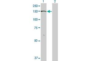 Lane 1: BMPR2 transfected lysate ( 115.