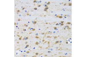 Immunohistochemistry of paraffin-embedded mouse brain using MAPK9 antibody (ABIN5970592) at dilution of 1/100 (40x lens). (JNK2 抗体)