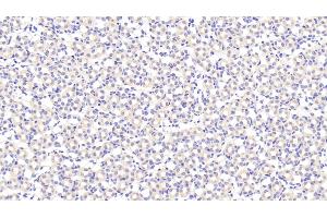 Immunohistochemistry (IHC) image for anti-Biglycan (BGN) (AA 53-166) antibody (ABIN7436627)