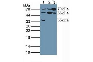 Western blot analysis of (1) Human Liver Tissue, (2) Human HeLa cells and (3) Rat Serum. (Butyrylcholinesterase 抗体  (AA 29-150))