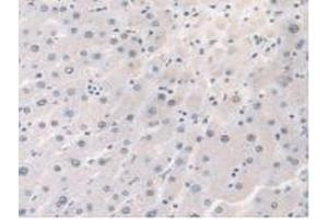 Detection of STX1A in Human Liver Tissue using Polyclonal Antibody to Syntaxin 1A, Brain (STX1A) (STX1A 抗体  (AA 1-255))