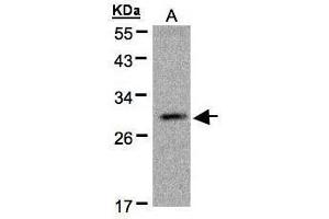 WB Image Sample(30 μg of whole cell lysate) A:MOLT4, 12% SDS PAGE antibody diluted at 1:500 (Kallikrein 2 抗体)
