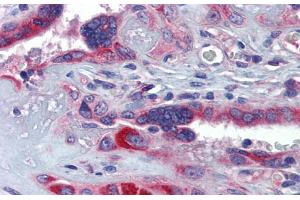 Immunohistochemistry with Human Placenta lysate tissue at an antibody concentration of 5. (GTPBP10 抗体  (Middle Region))