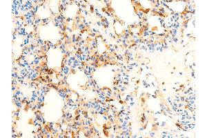 ABIN6267071 at 1/100 staining rat lung tissue sections by IHC-P. (SYK 抗体  (pTyr323))