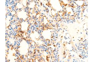 ABIN6267071 at 1/100 staining rat lung tissue sections by IHC-P.