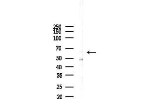 anti-Synovial Sarcoma, X Breakpoint 2 Interacting Protein (SSX2IP) (Internal Region) antibody
